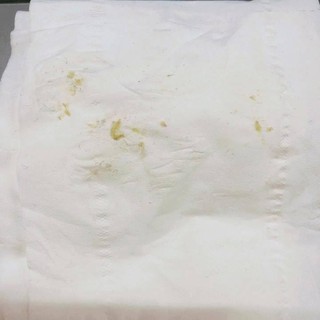 SON DƯỠNG CARMEX