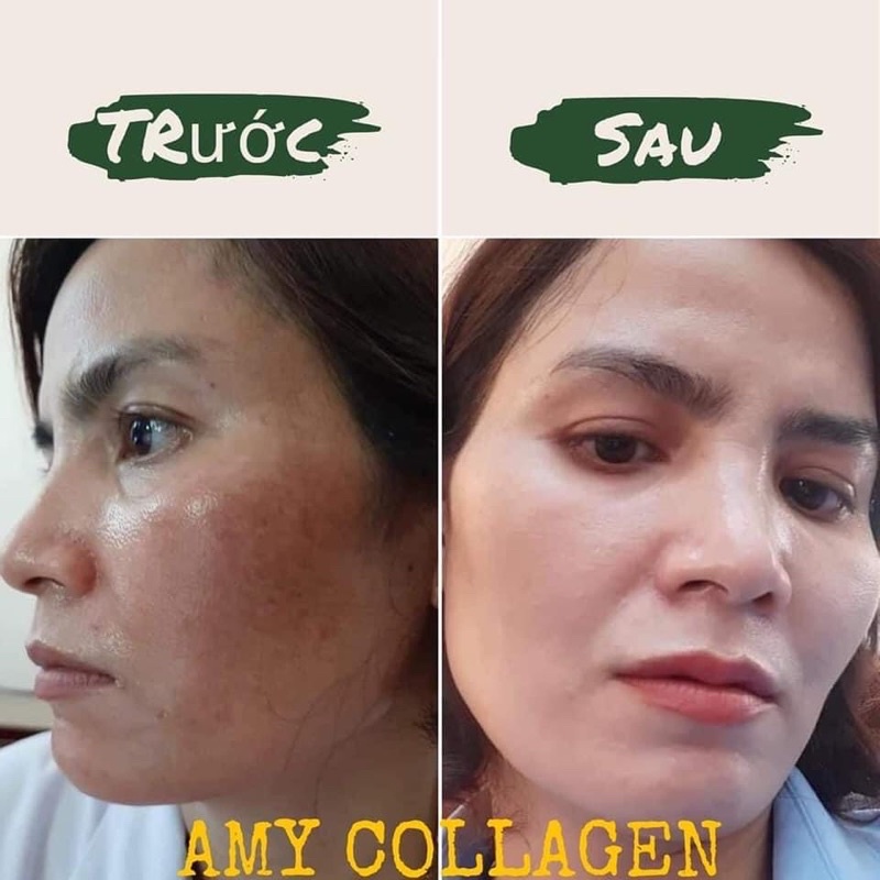 Đản bảo hiêu quả ngay từ bộ đâu tiên AMY COLAGEN