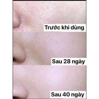 Serum Se Khít Lỗ Chân Lông