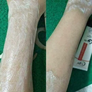 Kem tẩy lông