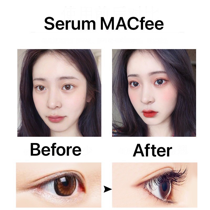 Serum kích mọc lông mi MACfee chứa thành phần thảo mộc hỗ trợ làm dày và dài mi sau 4 tuần sử dụng | BigBuy360 - bigbuy360.vn