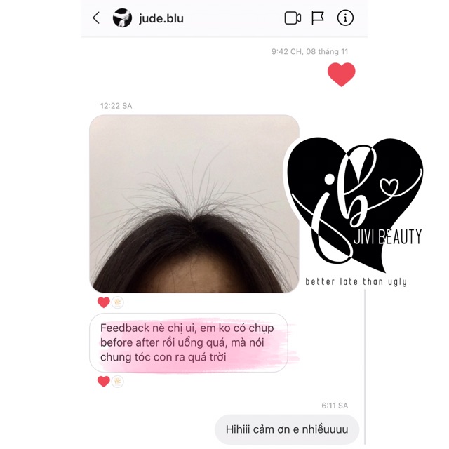 XỊT KÍCH MỌC TÓC GIẢM RỤNG | BigBuy360 - bigbuy360.vn