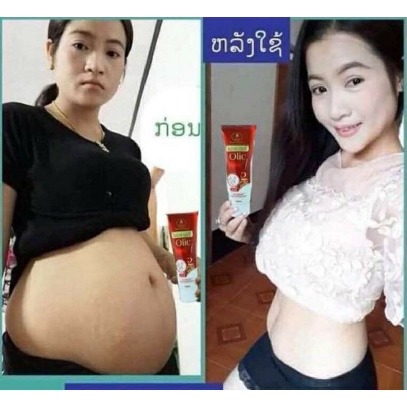 Gel tan mỡ olic( kem quế olic )bao hàng chính hãng công ty