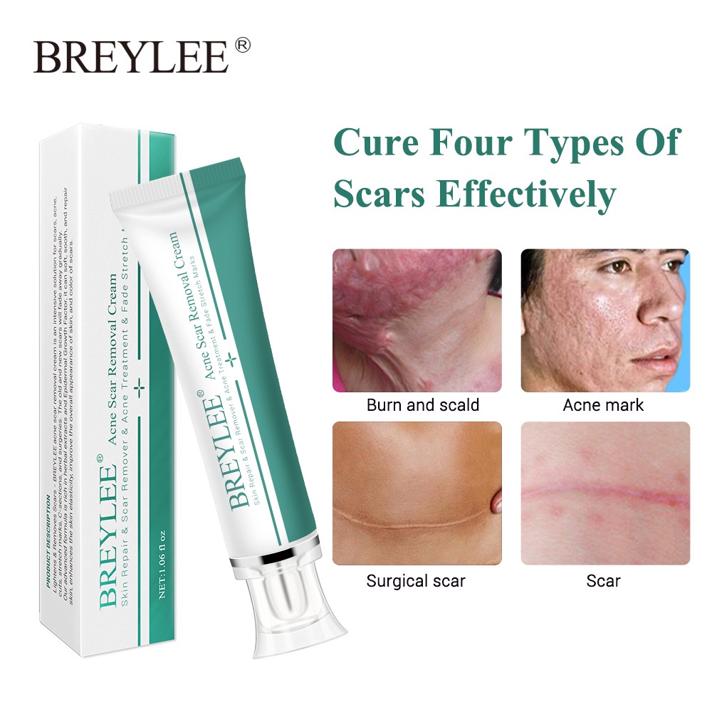 Hàng Có Sẵn Kem Trị Sẹo Breylee Kem Trị Sẹo Làm Mờ Vết Sẹo Mụn 30G Giảm Giá Mạnh Thanh Toán Khi Nhận Hàng