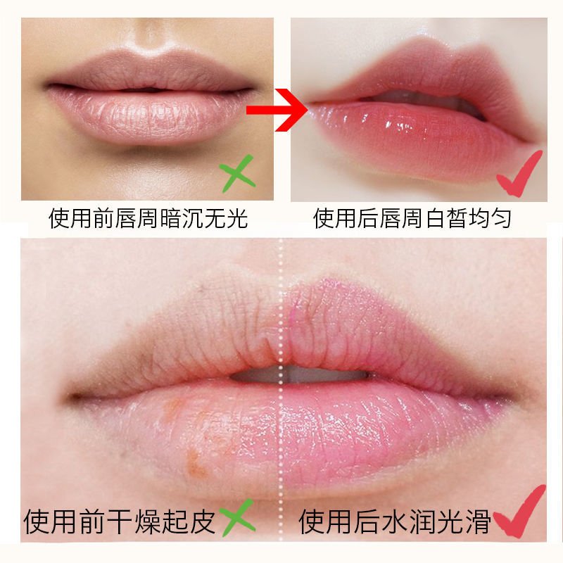 (hàng Mới Về) Gel Tẩy Tế Bào Chết Cho Môi Xiaoyuwan | BigBuy360 - bigbuy360.vn