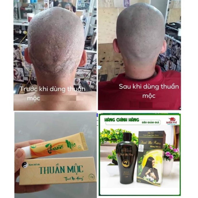 DẦU GỘI THANH MỘC HƯƠNG