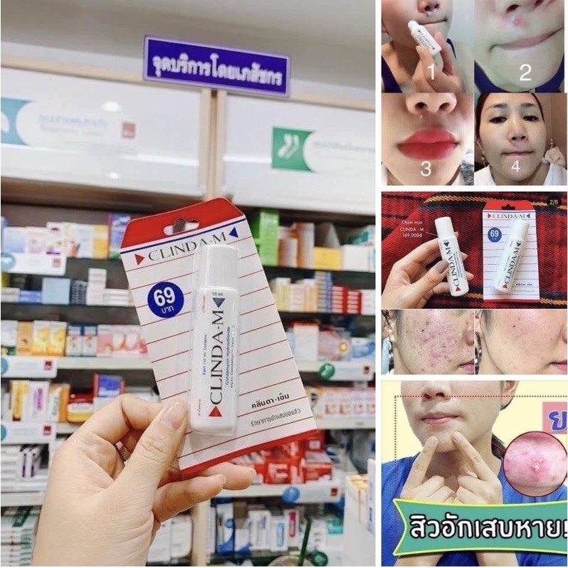 Kem Chấm Mụn Clinda-M, Tinh Chất Hỗ Trợ Giảm, Xẹp Mụn Clinda M Thái Lan