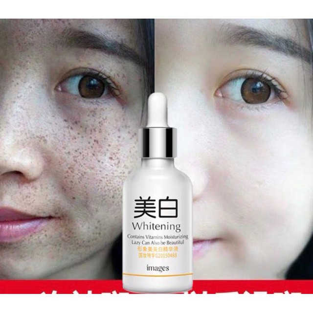 Serum V7 Whitening Dưỡng Trắng Da se khít lỗ chân lông Của Images