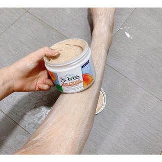 TẨY DA CHẾT BODY ST.IVES