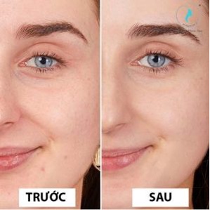 Serum huyết thanh dưỡng trắng da, mờ thâm, chống lão hoá ECOS Arbutin 5% Whiening
