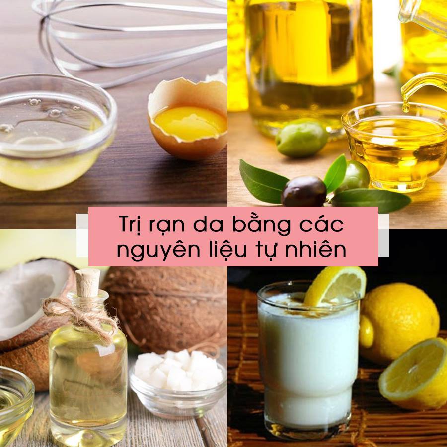 Combo Kem Palmer's Lotion Trị / Chống Rạn Sau Sinh Da  Sau Sinh Dưỡng Săn Chắc Da Của Mỹ Chính Hãng