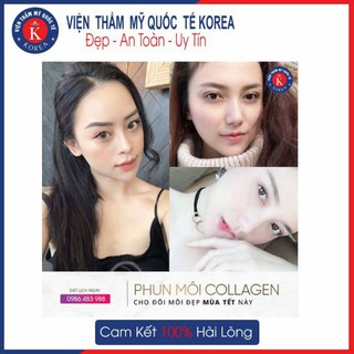 - Phun môi siêu vi chạm 8D không đau, không sưng, an toàn tại Viện Thẩm Mỹ Quốc Tế Korea