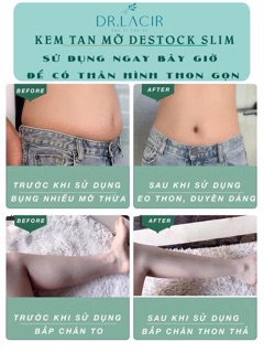 Bộ đôi kem tan mỡ và gen nịt bụng dr.slim - dr.Lacir