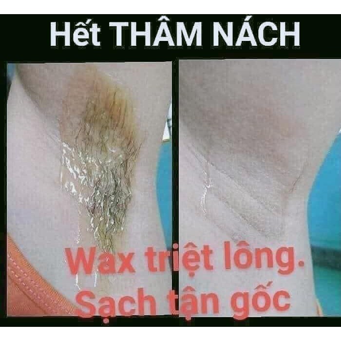 Kem tẩy lông nách, wax lông nách An Lành