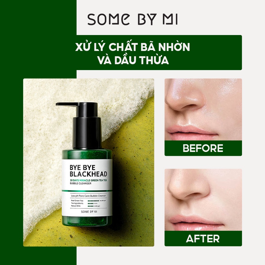 Sữa Rửa Mặt Dành Cho Da Mụn Đầu Đen SomeByMi Blackhead 30 Days Miracle Bubble Cleanser 120g