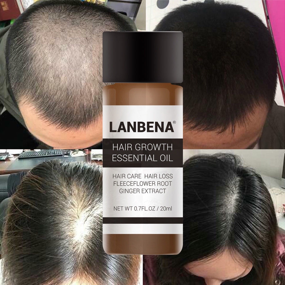 Lanbena mạnh mẽ tăng trưởng tóc tinh dầu điều trị chống rụng tóc chăm sóc tóc okase