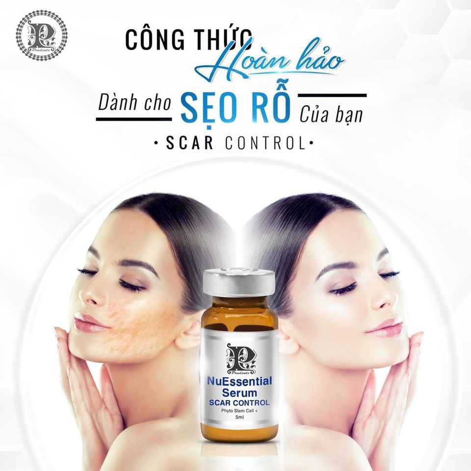 Tế Bào Gốc Trị Sẹo Rỗ Sẹo Lõm NuEssential Nuwhite