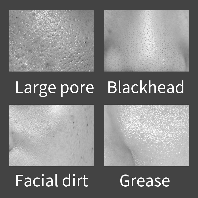 PFFEE 60g loại bỏ mụn đầu đen