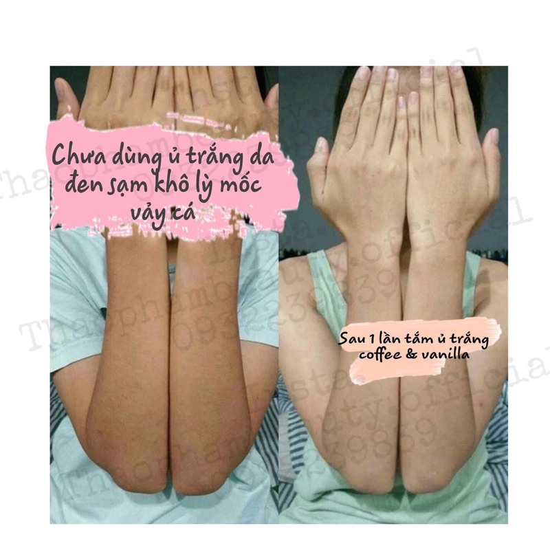 |SIÊU NÂNG TONE| TẮM TRẮNG NÂNG TONE SIÊU TRẮNG BODY - SUPER WHITENING BODY BATH