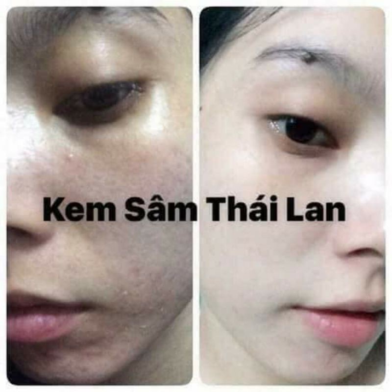 kem cô tiên Thái Lan