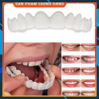 Dụng cụ niềng răng tại nhà snapon smile _(CÓ BẢO HÀNH) ( giao siêu nhanh )