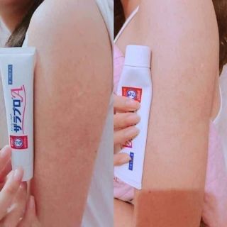 Kem trị viêm nang lông