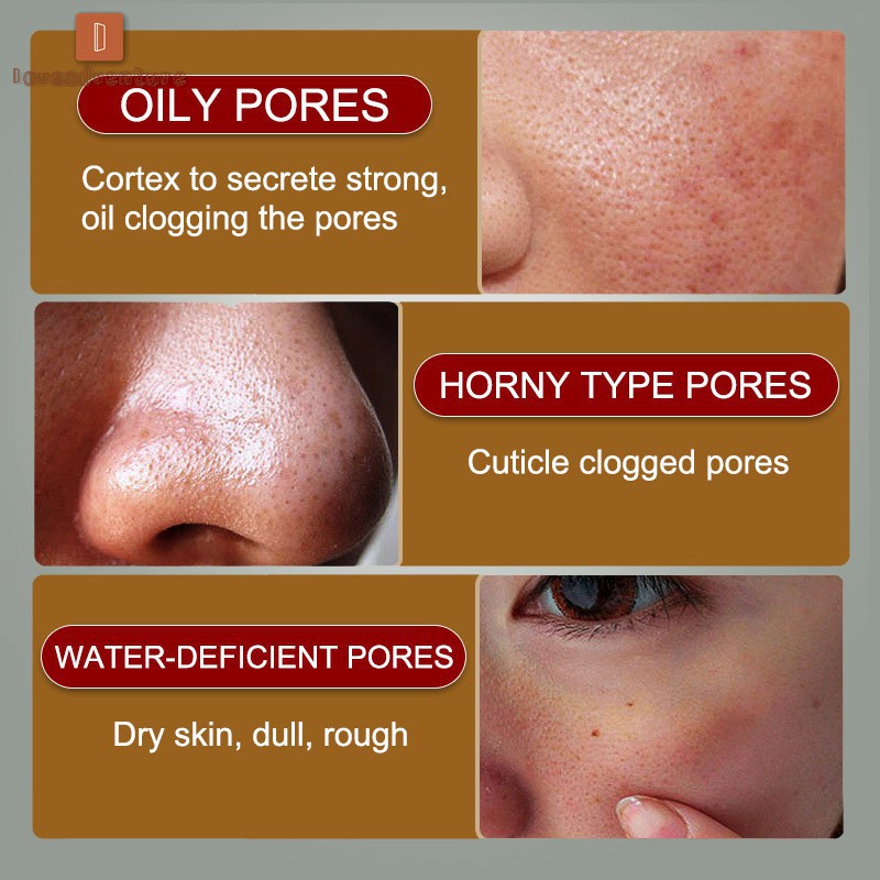 Tinh chất dưỡng ẩm se khít lỗ chân lông loại bỏ mụn đầu đen ! | BigBuy360 - bigbuy360.vn