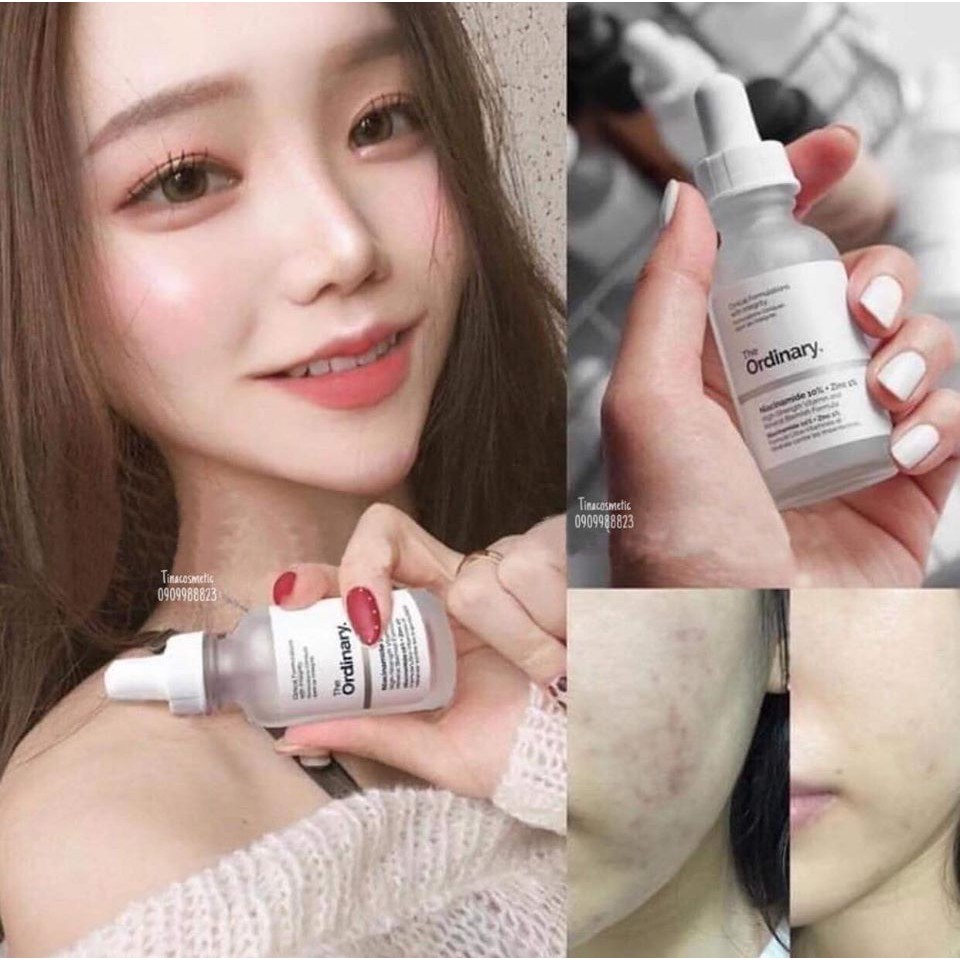 𝑻𝒉𝒆 𝑶𝒓𝒅𝒊𝒏𝒂𝒓𝒚 𝑵𝒊𝒂𝒄𝒊𝒏𝒂𝒎𝒊𝒅𝒆 10% + 𝒁𝒊𝒏𝑪 1% hỗ trợ #trị_mụn #mờ_thâm