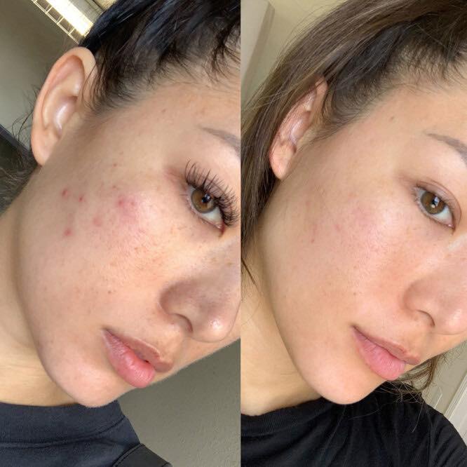 Neulii-Tinh chất phục hồi da tổn thương CicaPepta Repair serum