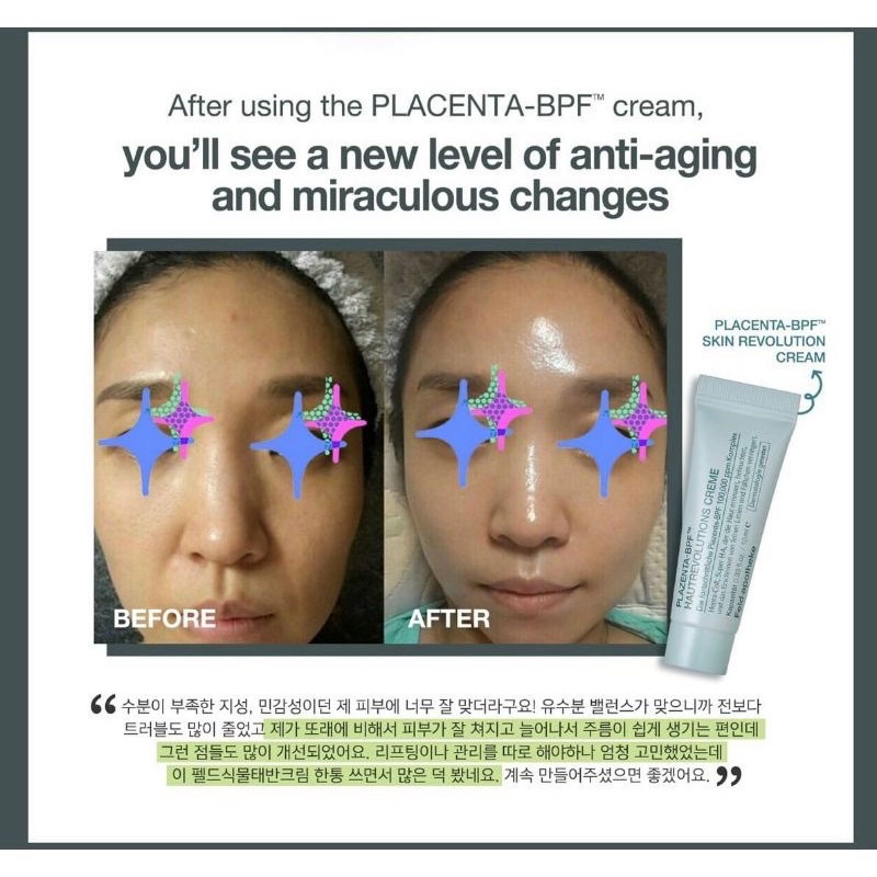 Kem Nhau Thai Phục Hồi Da Plazenta - BPF Skin Revolution Cream Feld Apotheke 10g