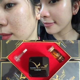 Kem Face White skin cream