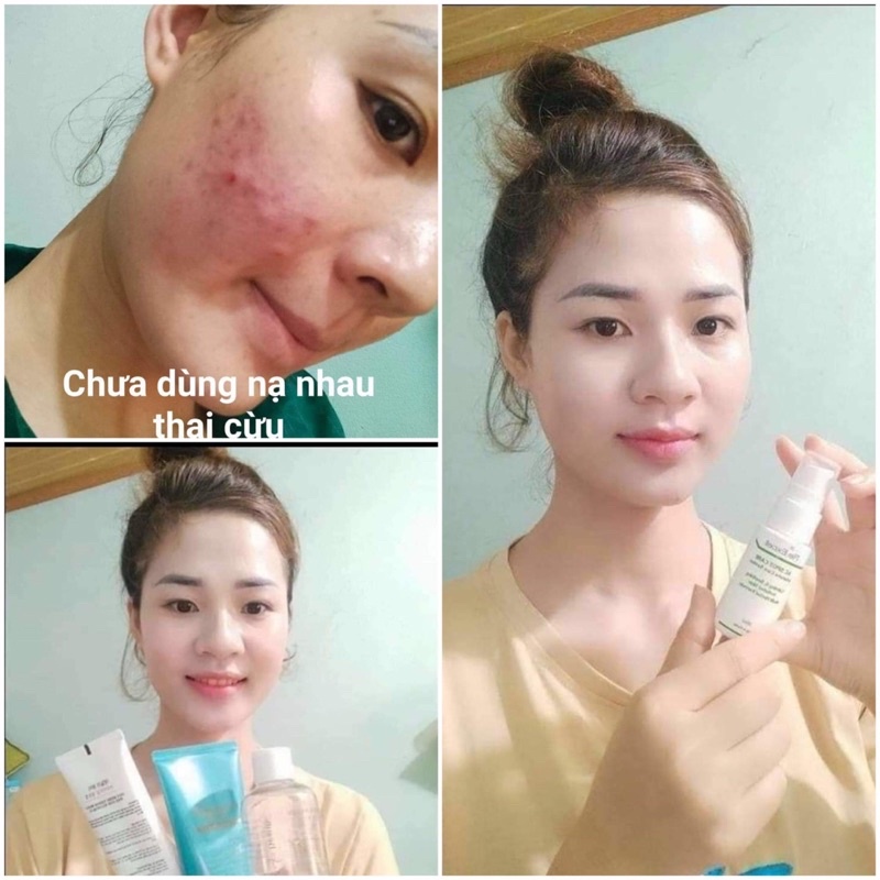 Mặt Nạ Nhau Thai cừu Hàn Quốc