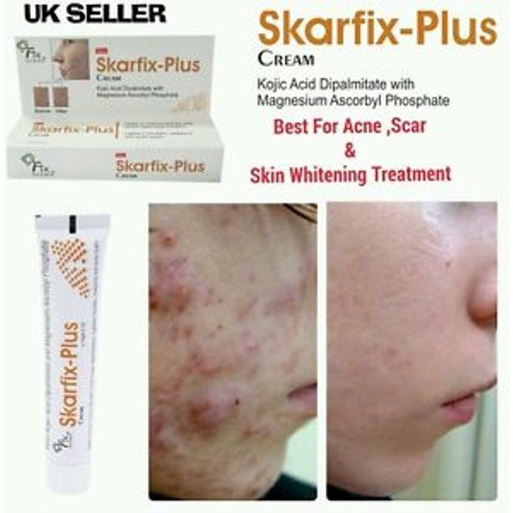 Fixderma Kem Giảm Thâm Nám - Dưỡng Da  Skarfix Plus Cream (15g)