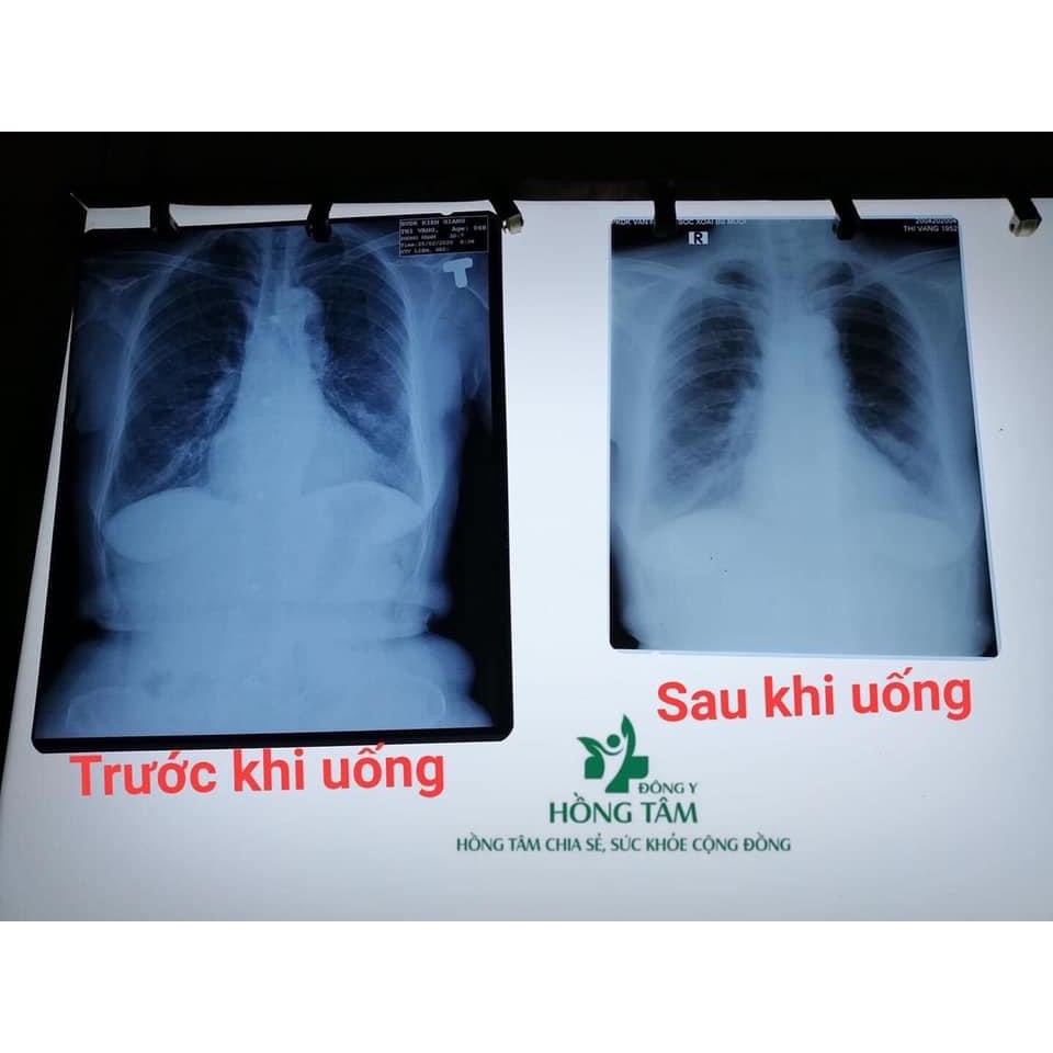 [ FREESHIP] Siro kháng khuẩn_detox thanh lọc phổi (120ml) tăng cương sức đề kháng hiệu quả chỉ sau 1 tuần sử dụng. | BigBuy360 - bigbuy360.vn