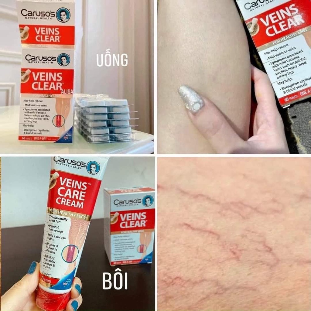 Viên uống giãn tĩnh mạch carusos venis clear caruso's 60 viên, kem bôi giãn tĩnh mạch venis clear cream caruso's 75g