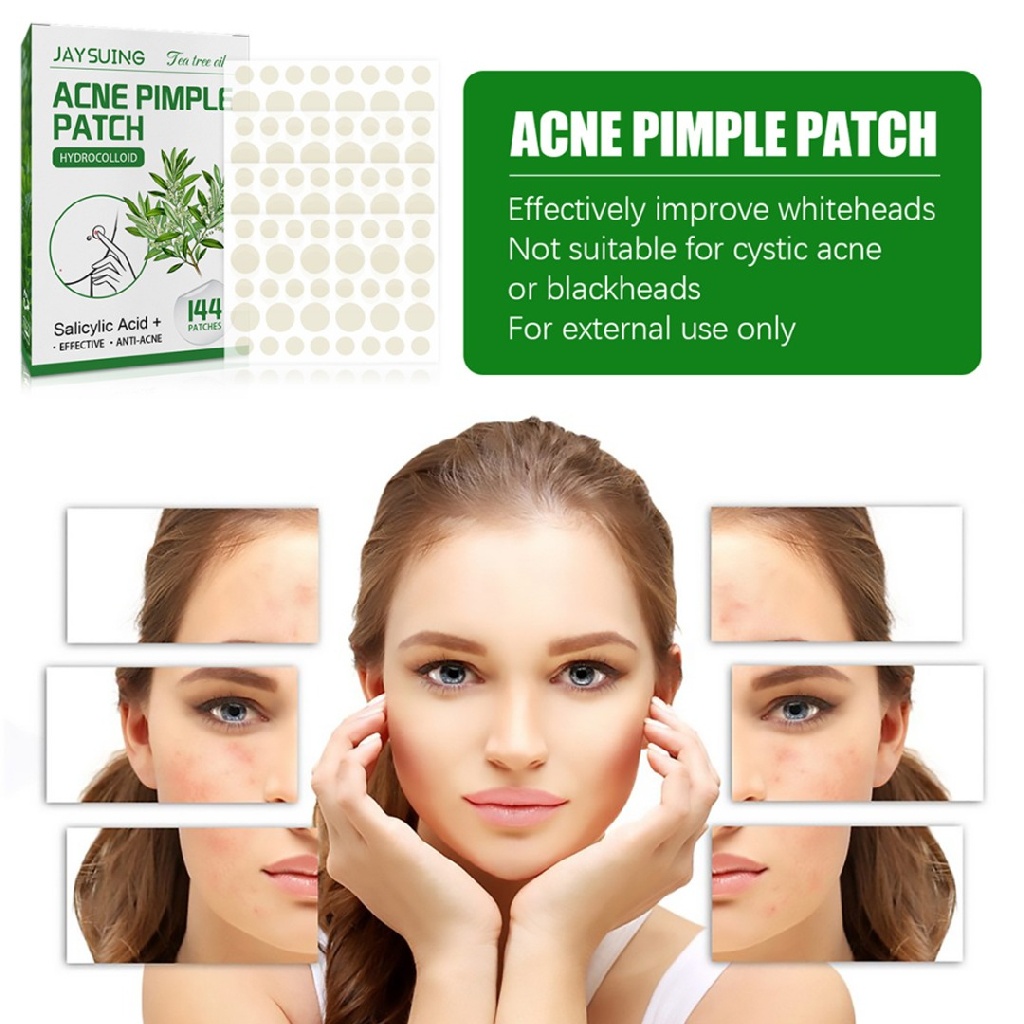 [Hàng mới về] Set 144 miếng dán mụn vô hình siêu mỏng