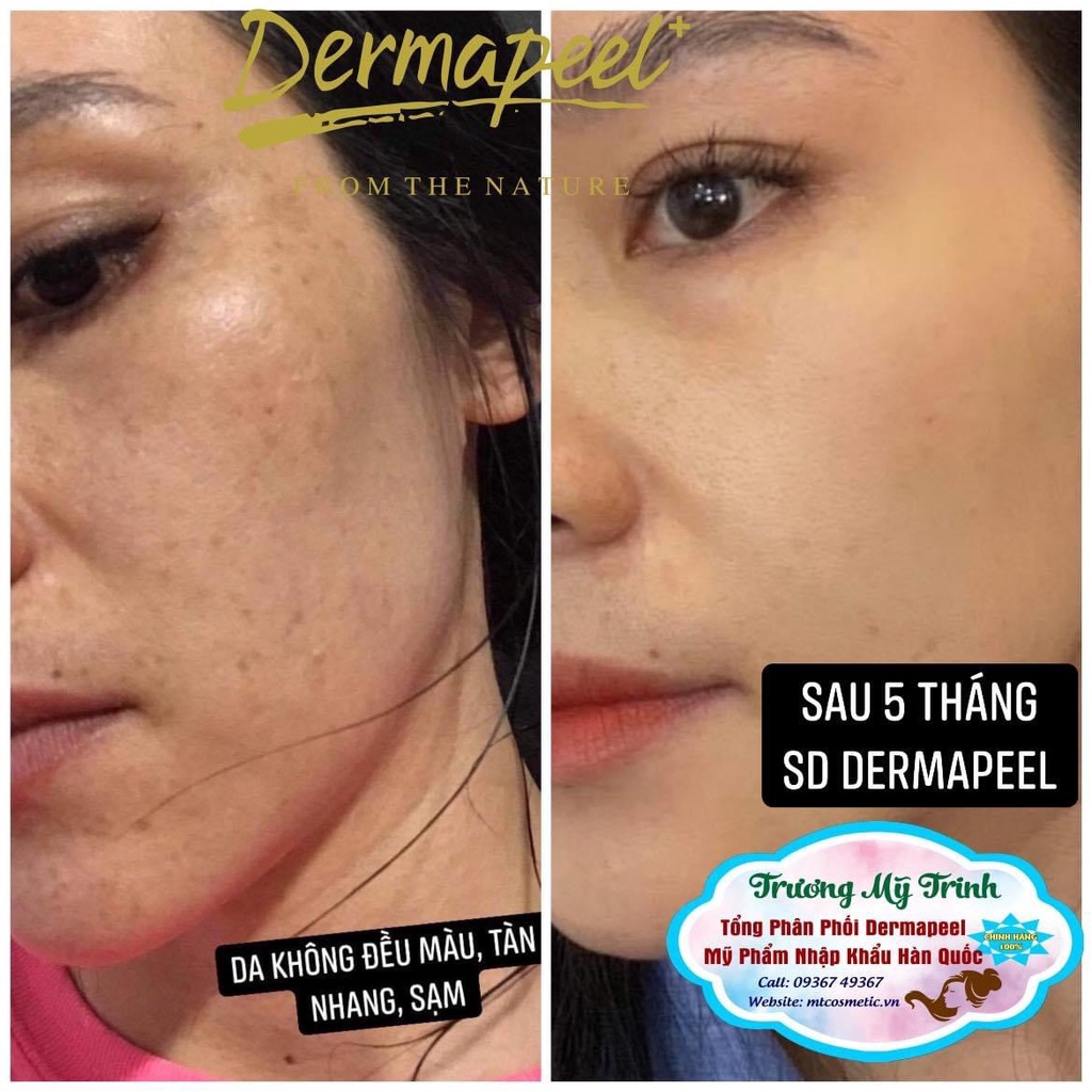 Combo trắng da - mờ nám - Tảo Trứng Cá Tuyết - Tinh Tảo Băng - Nạ hữu cơ - Phục Hồi Mô Da - Dày Thành Da Chuẩn SPA