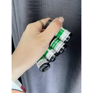 Chấm nám tàn nhang