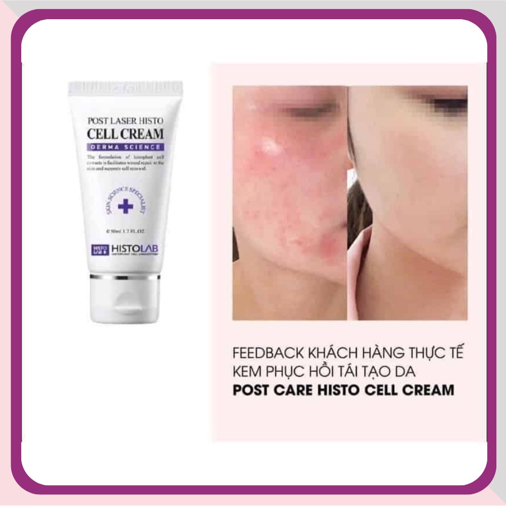 Post Care Histo Cell Cream - K Cream, kem dưỡng ẩm phục hồi da Histolab 50ml dành cho da sau treatment, phục hồi 50mL