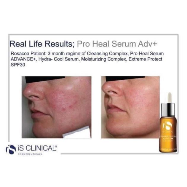 Serum Vitamin C IS Clinical Pro Heal Serum Advance Plus 30ml/60ml Giúp Làm Sáng Da Mờ Thâm Giảm Nám