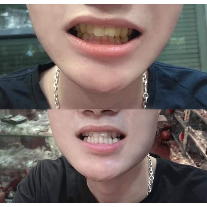 Than hoạt tính trắng răng MAX SMILE khử mồi hôi miệng, giảm ố vàng, răng trắng tự nhiên