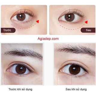 Máy massage mặt Notime