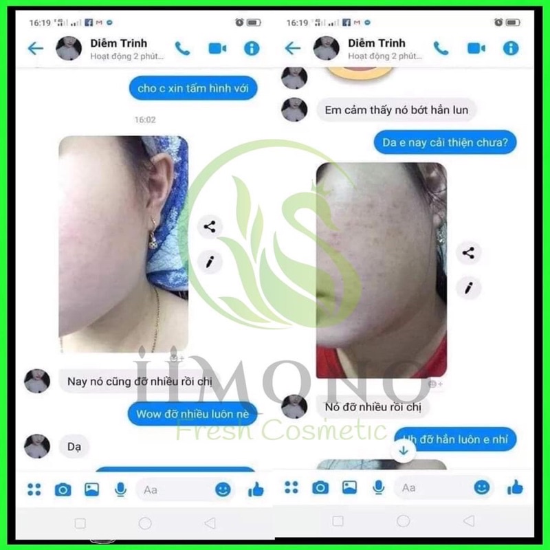 Tinh chất mụn IIMONO 6ml | BigBuy360 - bigbuy360.vn