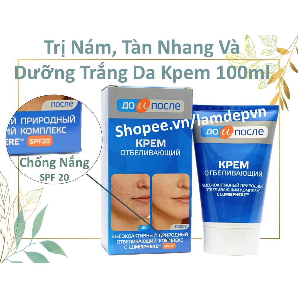 Loại bỏ Nám, Tàn Nhang Và Dưỡng Trắng Da Kpem (Kèm Chống Nắng SPF 20)