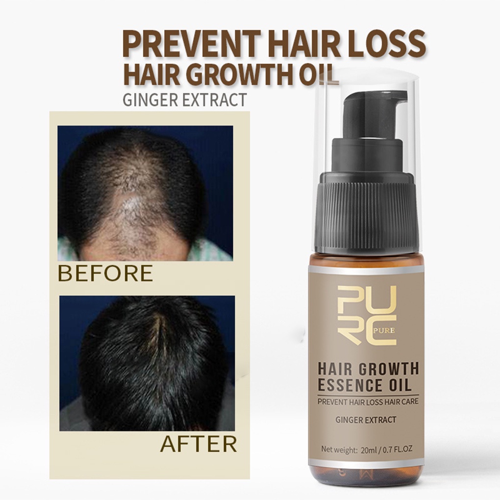 [Hàng mới về] Tinh dầu kích thích mọc tóc PURC dạng xịt nuôi dưỡng chống rụng tóc 20ml cho nam nữ