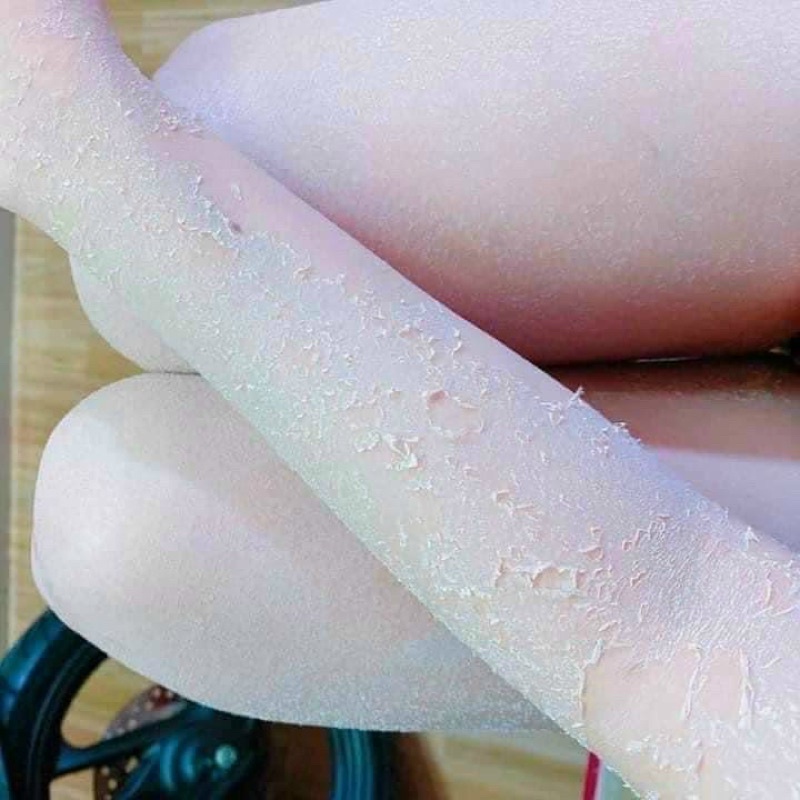 KEM BODY BONG TÁI TẠO DA 100gram - THÁCH THỨC MỌI LÀN DA ĐEN SẠM