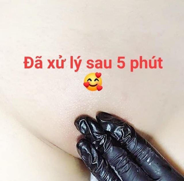 KEM TRIỆT LÔNG BIKINI | BigBuy360 - bigbuy360.vn