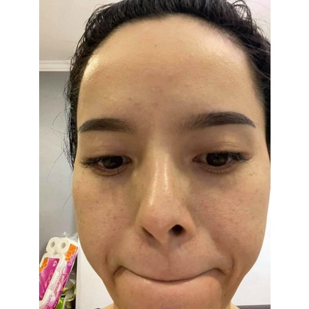 Kem nám cao cấp Happy - Melasma Treatment Cream Happy | BigBuy360 - bigbuy360.vn