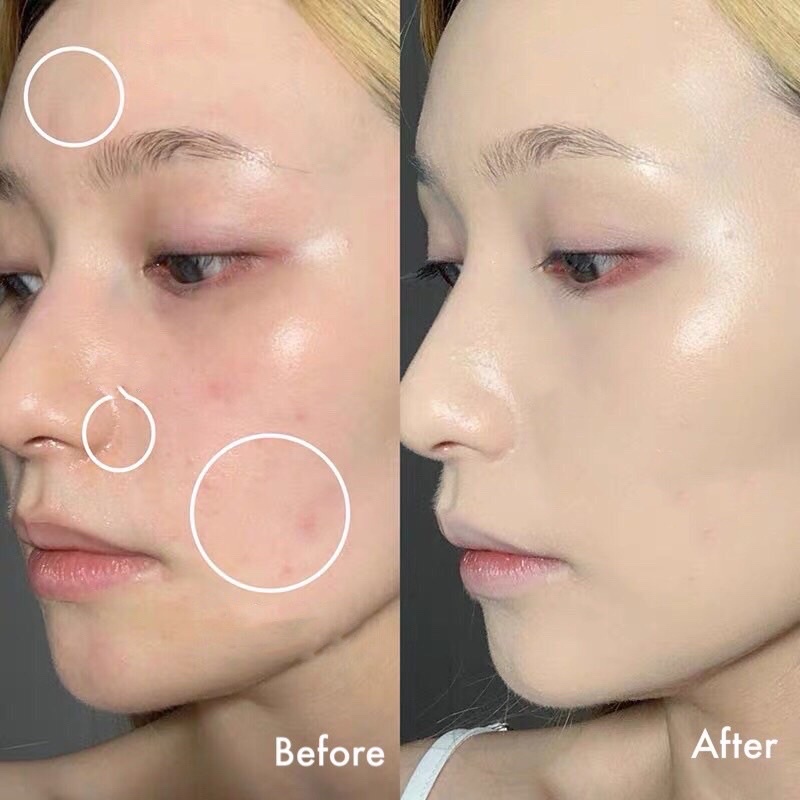 Che Khuyết Điểm, Kem Che Khuyết Điểm 3 Ô Che Phủ Quầng Thâm, Mụn Nám Tàm Nhang