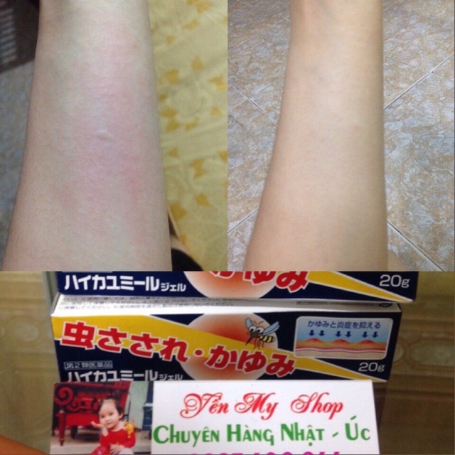 bôi muỗi muhi